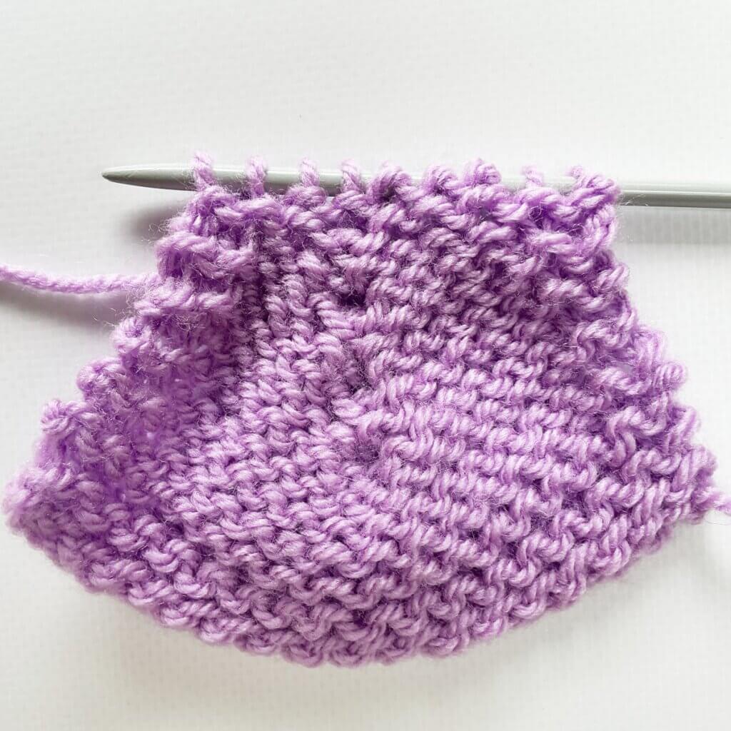 Multiple sl3-k1-p3sso decreases as seen from the WS